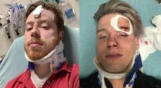 Texas gay couple Spencer Deehring and Tristan Perry were both hospitalised after the brutal anti-gay attack.