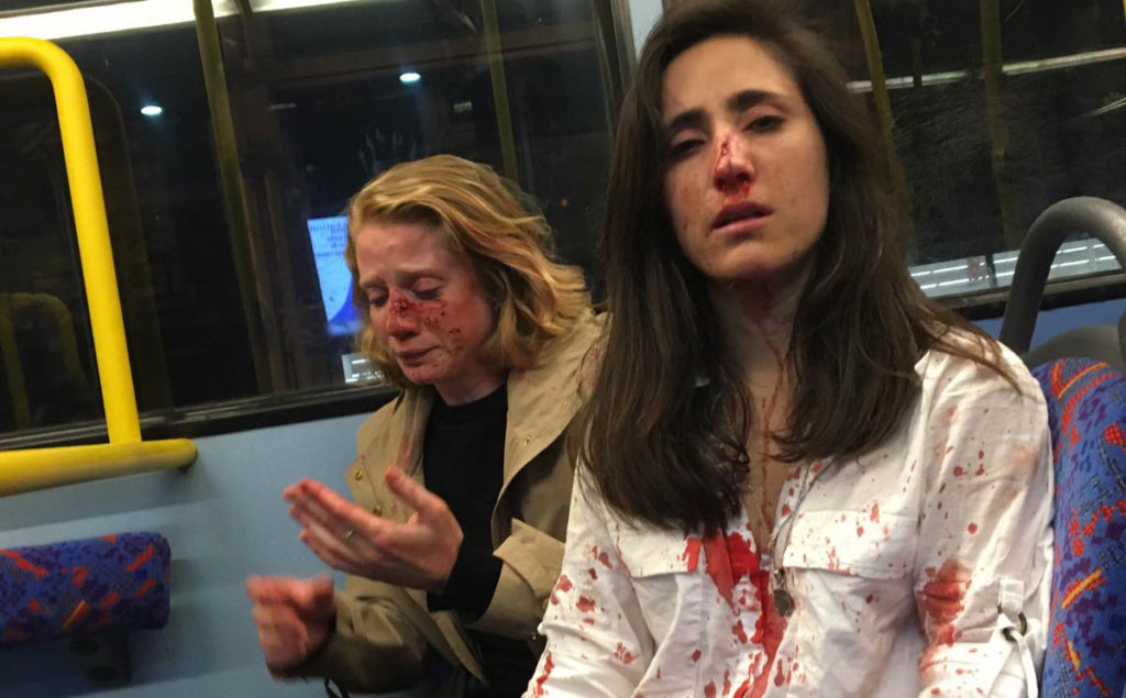 Two women on a bus covered in blood after alleged homophobic attack