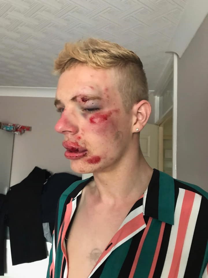 Ryan Williams was beaten up for being gay