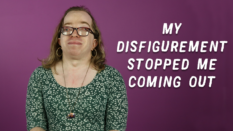 Disabled_disfigured_gay_transwoman