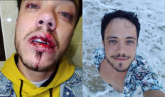 A gay man was viscously assaulted by a gang after kissing his boyfriend in Dublin. (Danilo Matta)