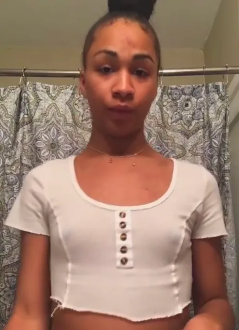 Trans woman Iyanna Dior documented her injuries in a Facebook Live
