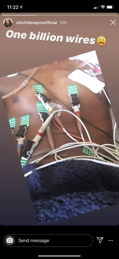 Chi Chi DeVayne's torso with wires attached