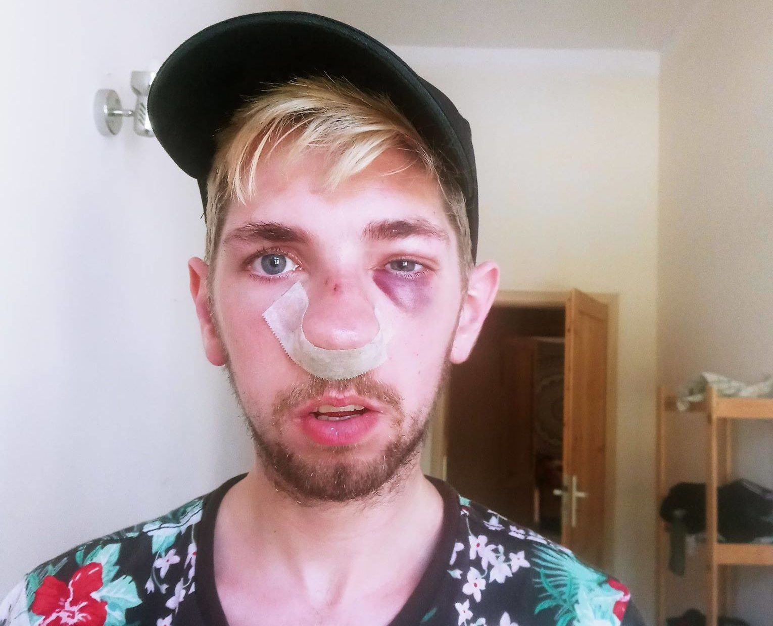 Poland Gay Man Brutally Attacked By Drunk Thugs I