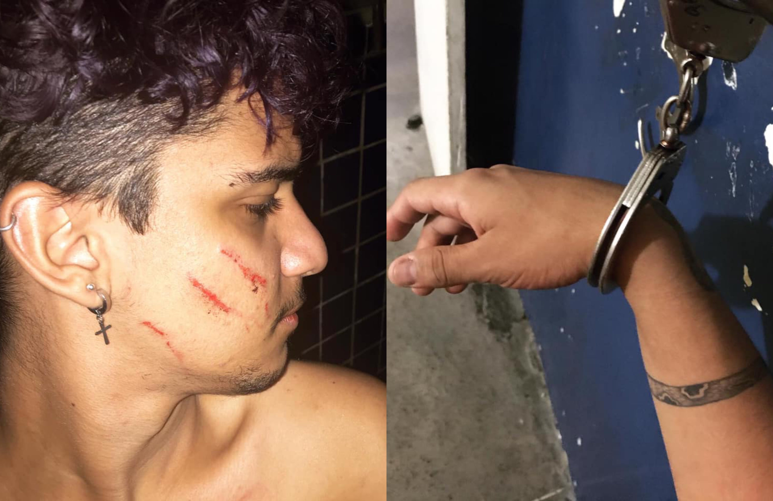 Lorran Oliveira, a 21-year-old photographer, was beaten with a broomstick by a neighbour. (Facebook)