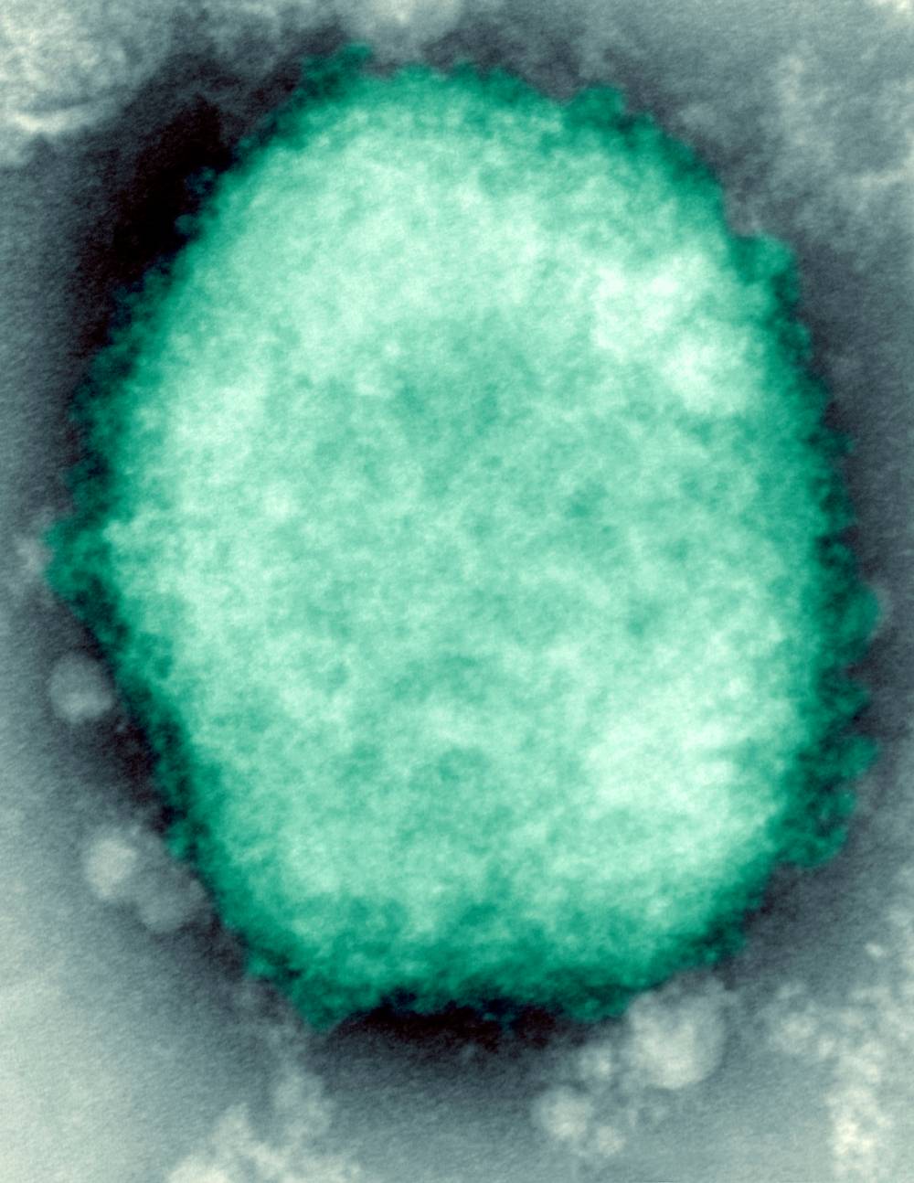 Monkeypox virus, represented with blueish-green colouring, present in human vesicular fluid that is depicted in monochromatic colouring