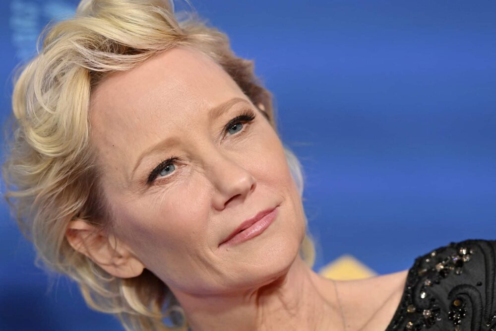 Anne Heche dies aged 53 after brain injury from catastrophic car crash